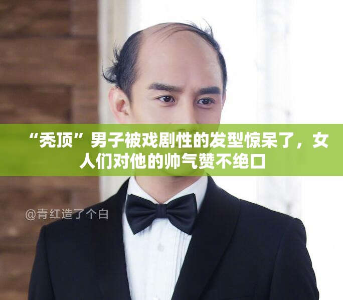 “秃顶”男子被戏剧性的发型惊呆了，女人们对他的帅气赞不绝口